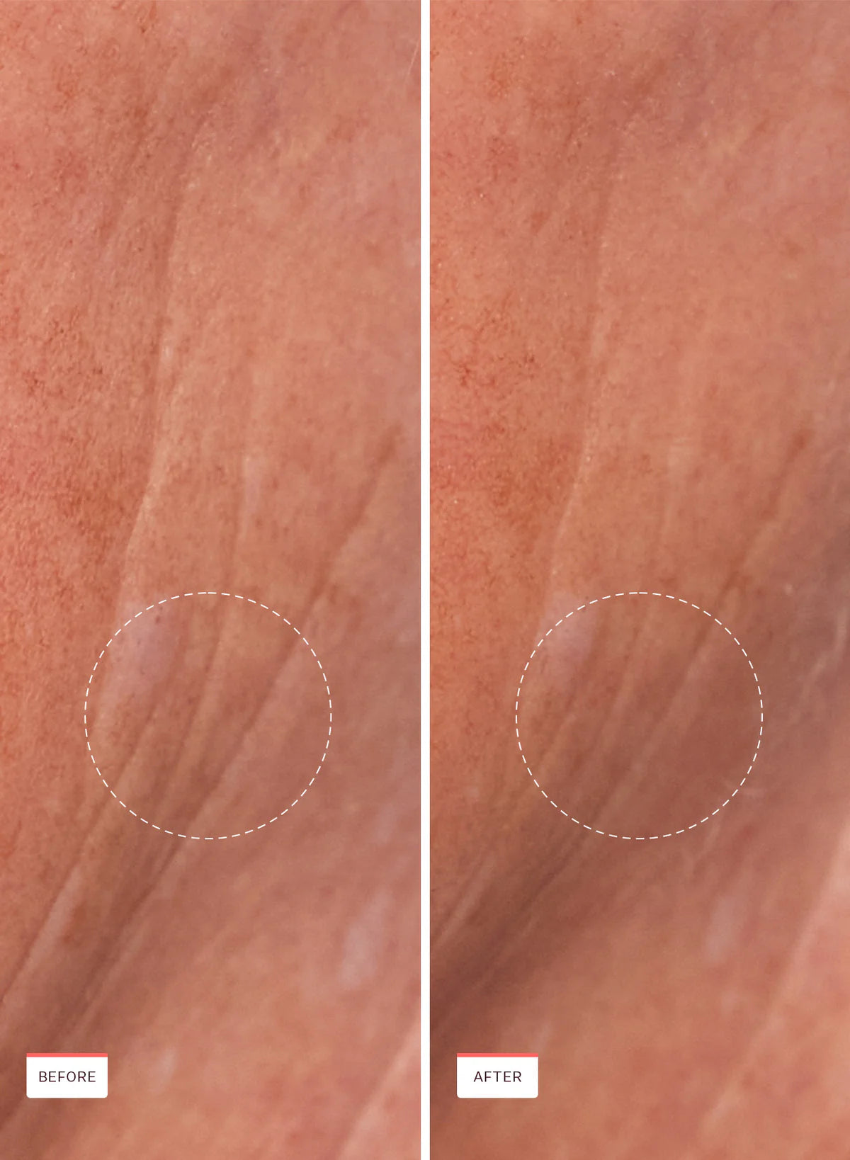 PEACH & LILY | PEPTIDE PRO FIRMING MOISTURIZER (CREMA REAFIRMANTE)