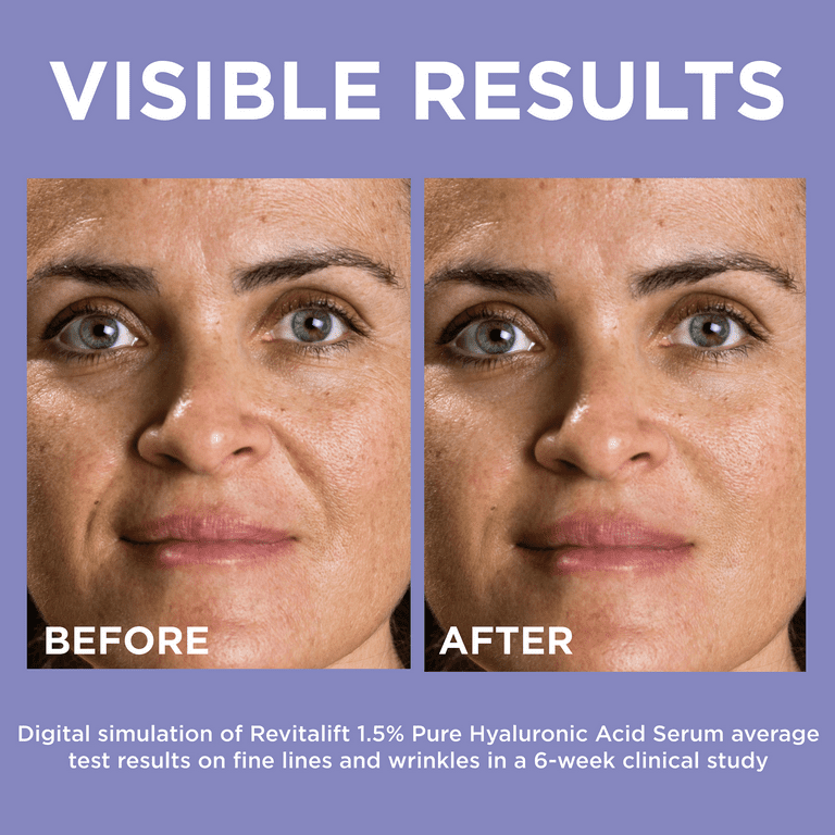 L'OREAL PARIS REVITALIFT, SUERO DE 1,5% PURO ÁCIDO HIALURÓNICO 15 ml