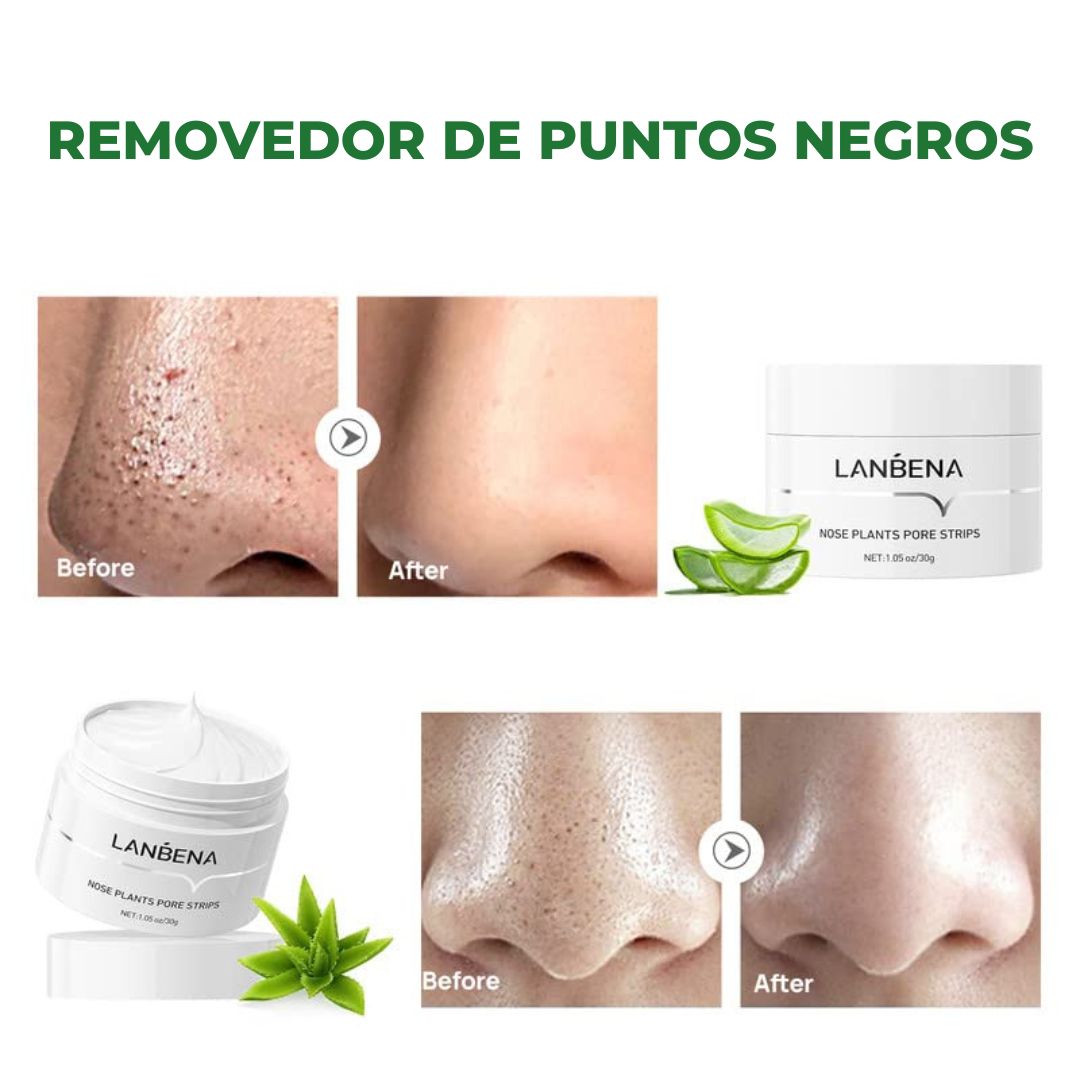 LANBENA, REMOVEDOR DE PUNTOS NEGROS