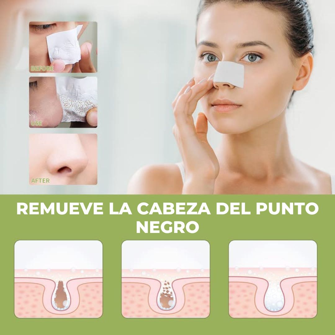LANBENA, REMOVEDOR DE PUNTOS NEGROS