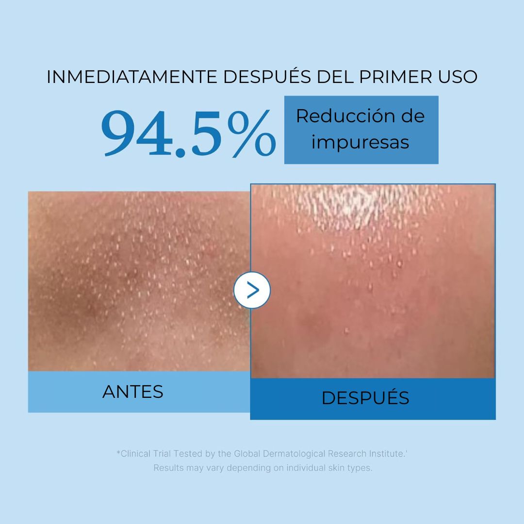 MEDICUBE ZERO PORE - ACEITE DE LIMPIEZA PROFUNDA PARA PUNTOS NEGROS Y MAQUILLAJE