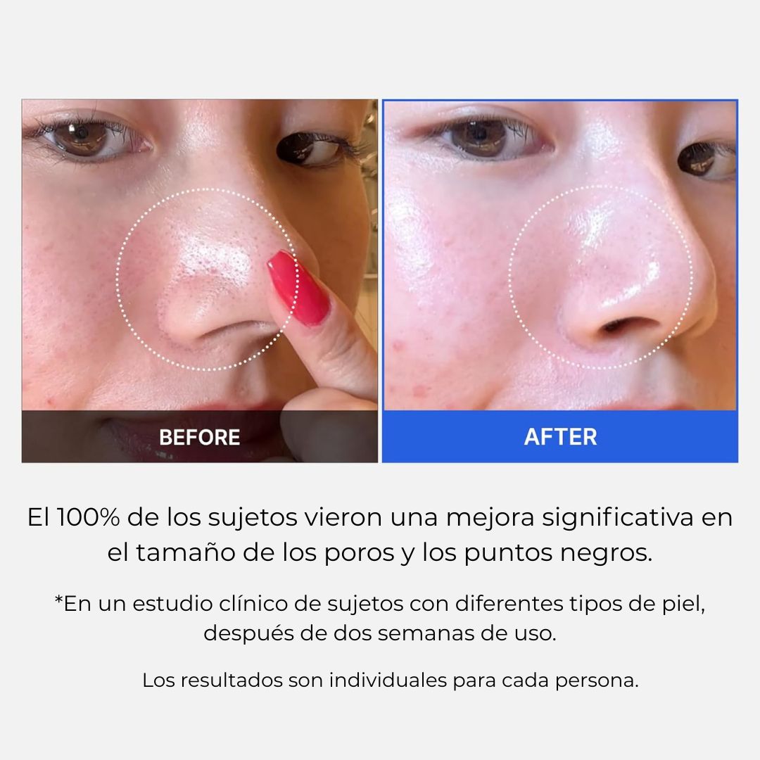 MEDICUBE ZERO PORE - ACEITE DE LIMPIEZA PROFUNDA PARA PUNTOS NEGROS Y MAQUILLAJE