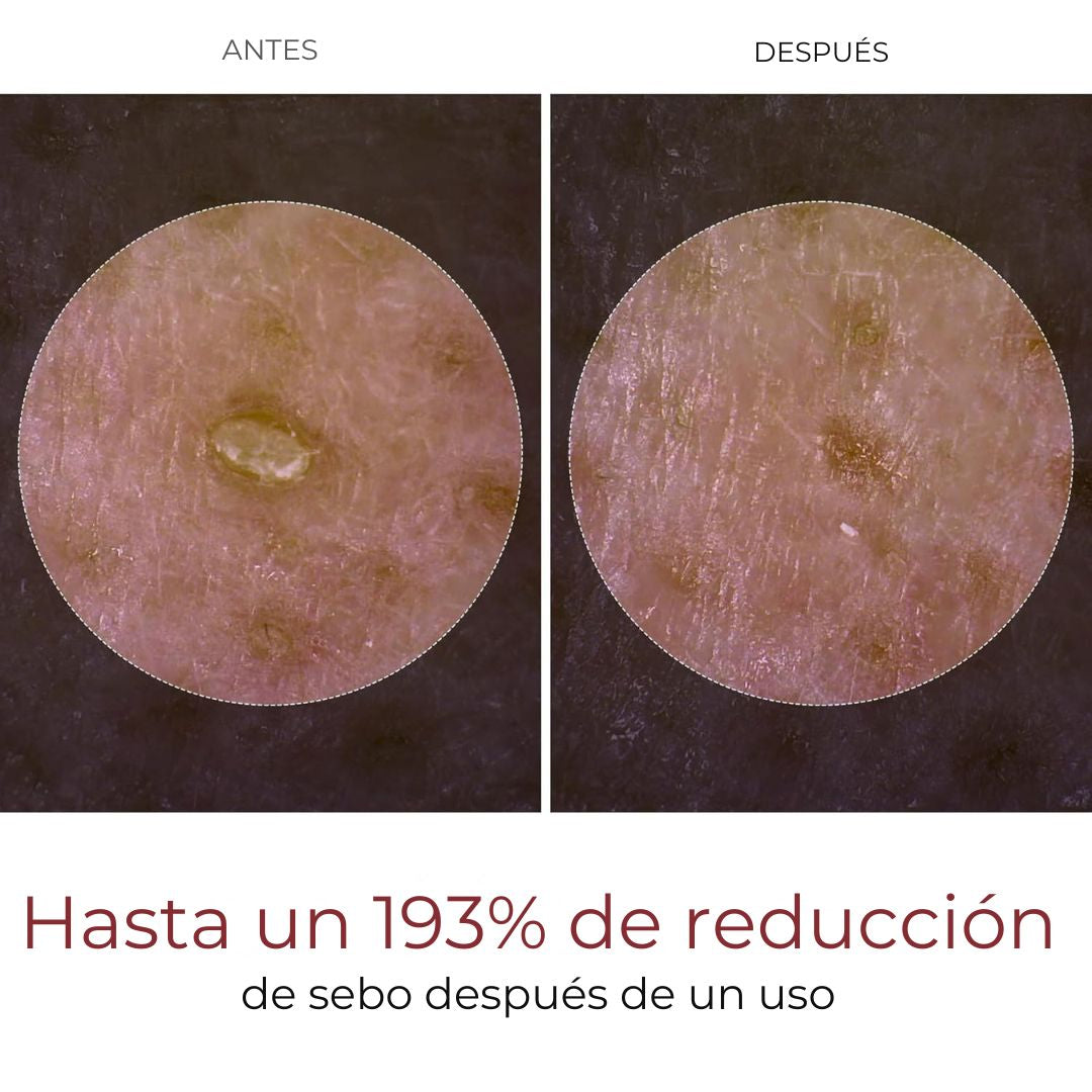 DR.MELAXIN PEEL SHOT - AMPOLLA EXFOLIANTE DE ARROZ SUAVE