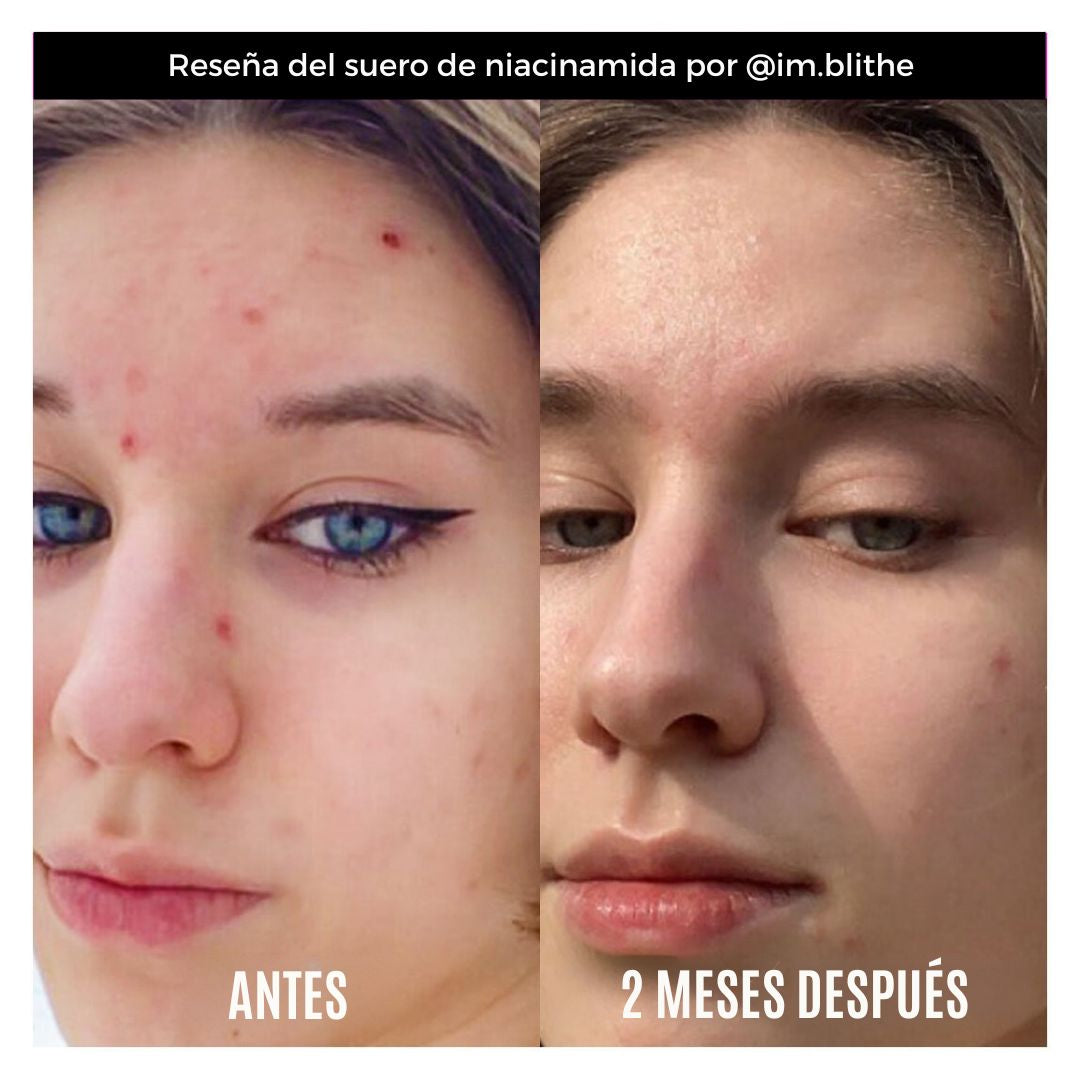 GOOD MOLECULES NIACINAMIDE SERUM 30 ML