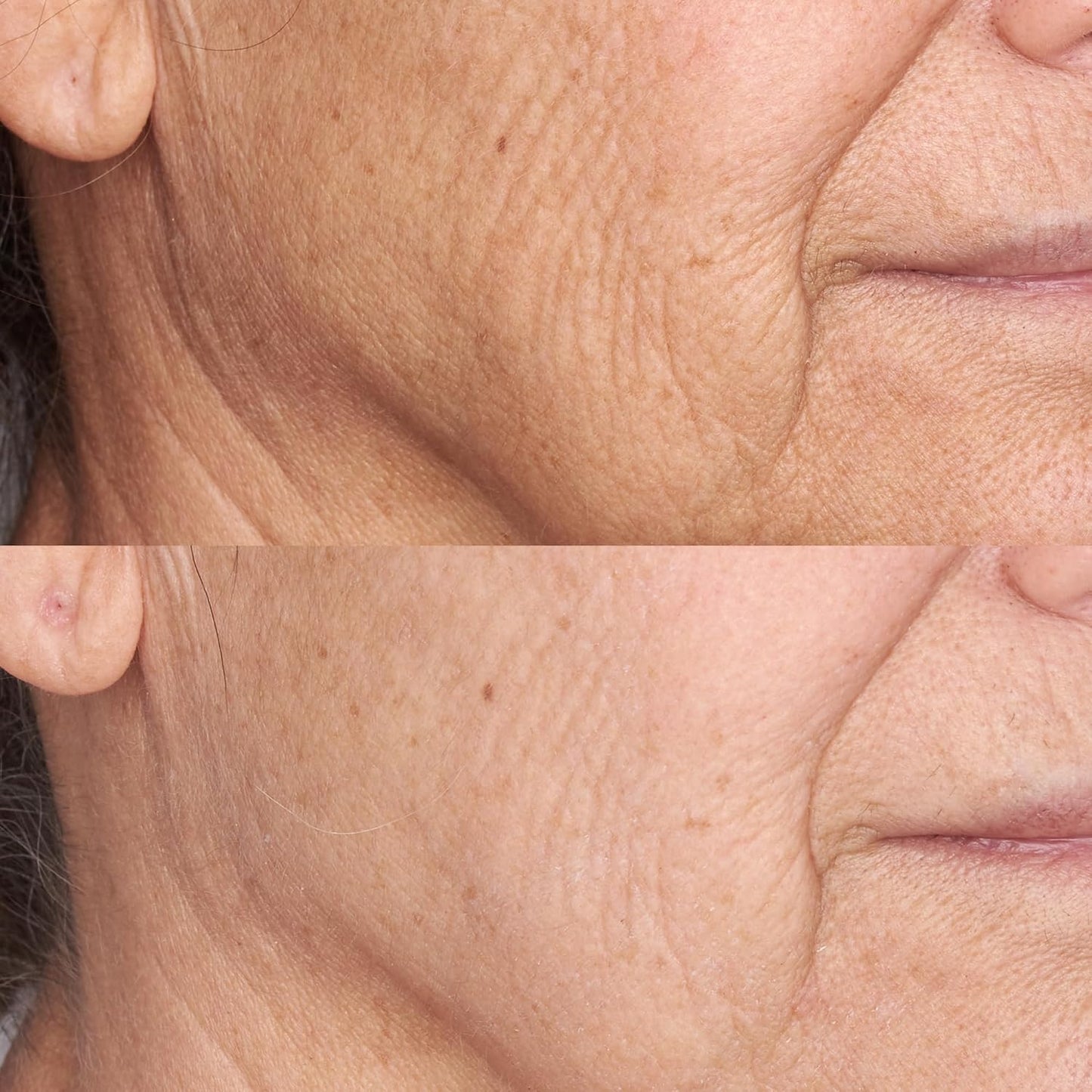PERRICONE MD | DÚO DE CREMA HIDRATANTE FACIAL DE ALTA POTENCIA PARA ACABADO Y REAFIRMACIÓN