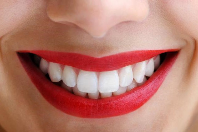 VITIS PASTA DE DIENTES BLANQUEADORA